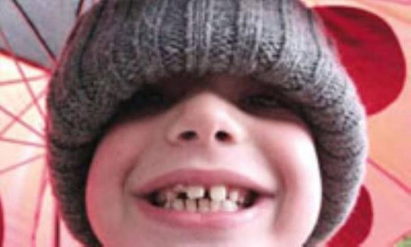چگونه از دندان های شیری بچه ها مراقبت کنیم؟